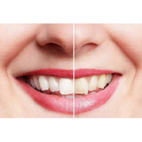 Diamond Dental Center